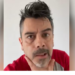 Carlos Espejel aparece con parálisis facial; atribuye su estado al estrés