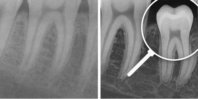 Dentistas digitales en México: planificación 3D para implantes más precisos y mejor diagnóstico